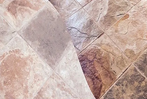 Link to the StoneCare4U website